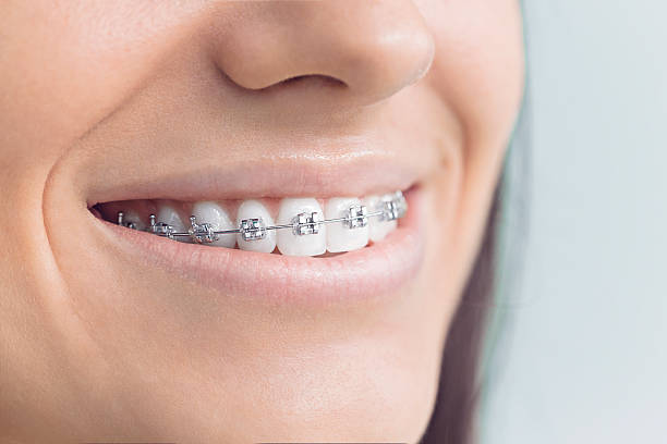 Best Veneers and Lumineers  in Grandview, WA